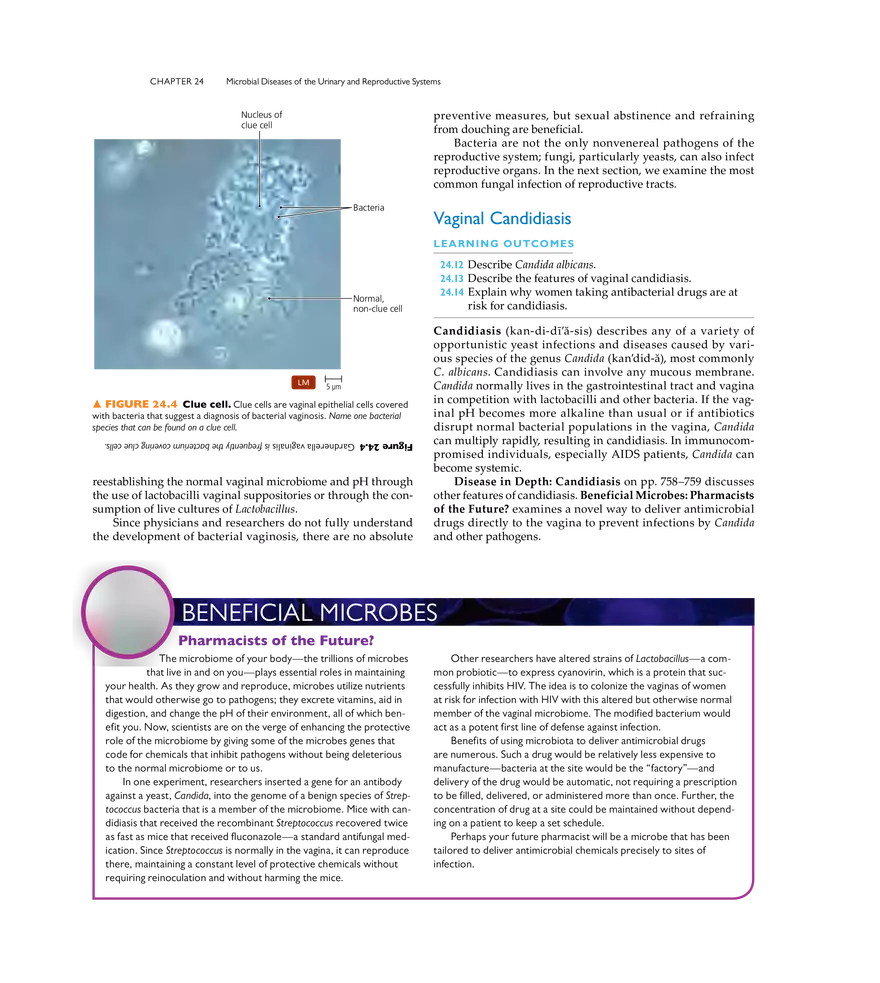 Microbial Diseases of the Urinary and Reproductive Systems - Page 28
