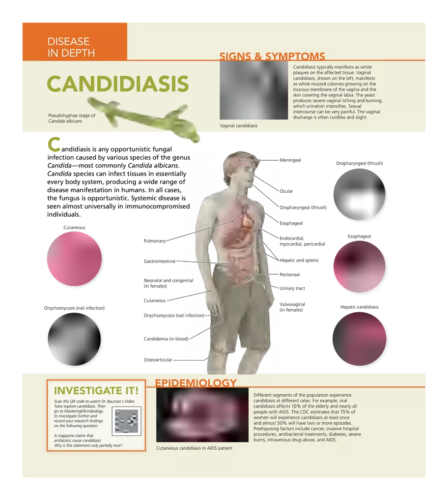 Microbial Diseases of the Urinary and Reproductive Systems - Page 3