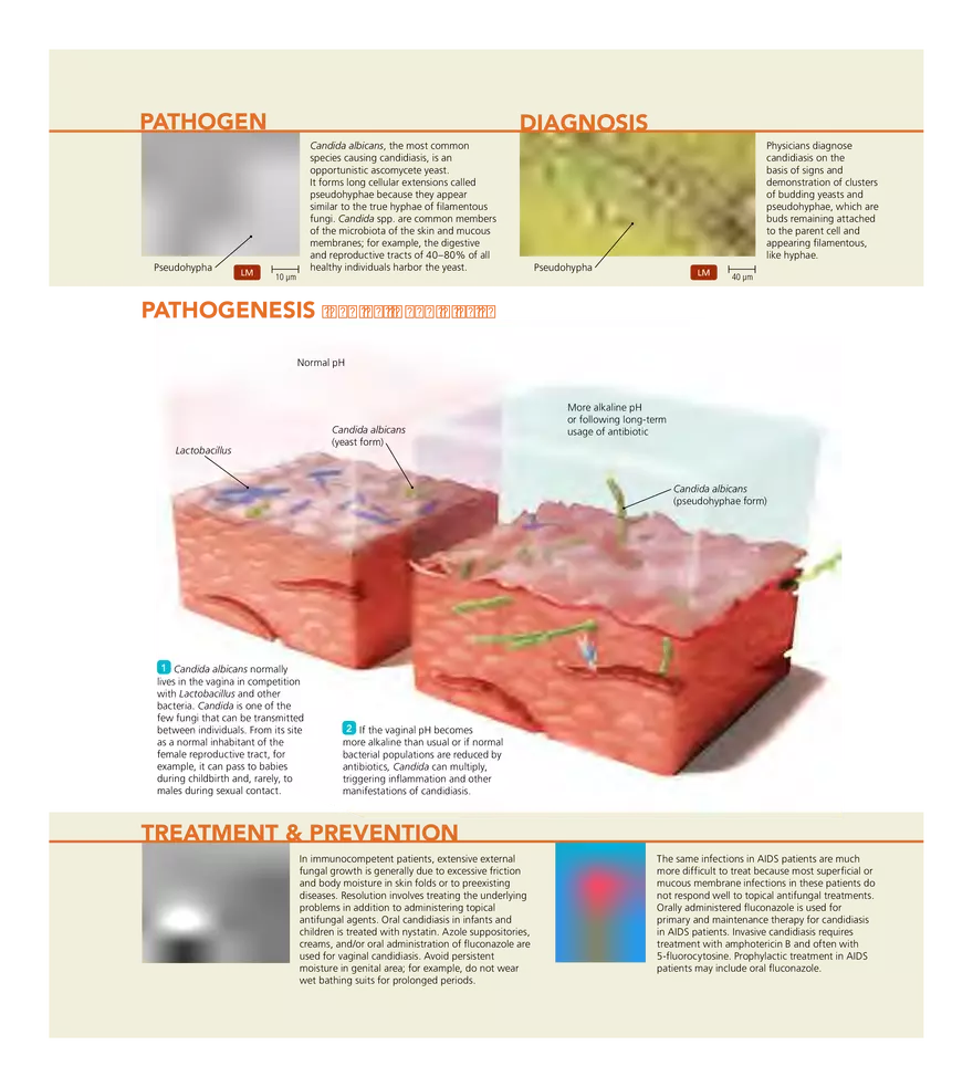 Microbial Diseases of the Urinary and Reproductive Systems - Page 4