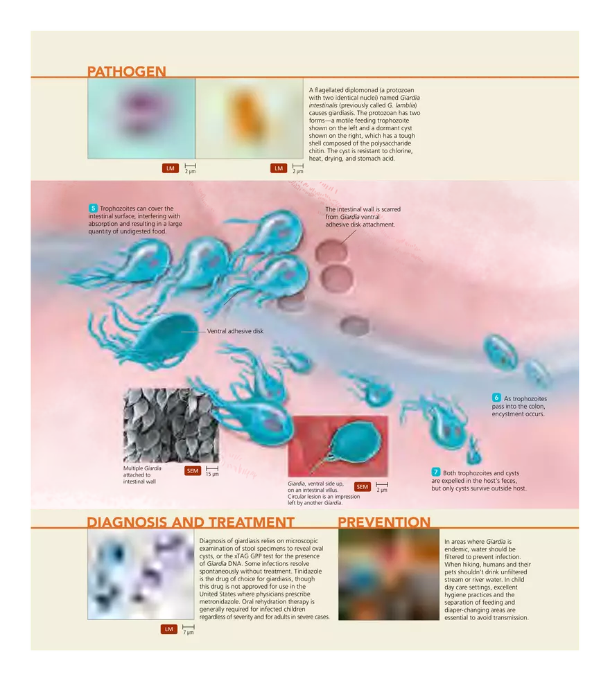 Microbial Diseases of the Digestive System - Page 19