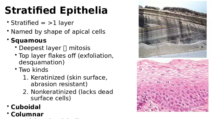 Chapter 5 Tissues – Epithelial, Connective, Muscle, Nervous, Membranes - Page 12