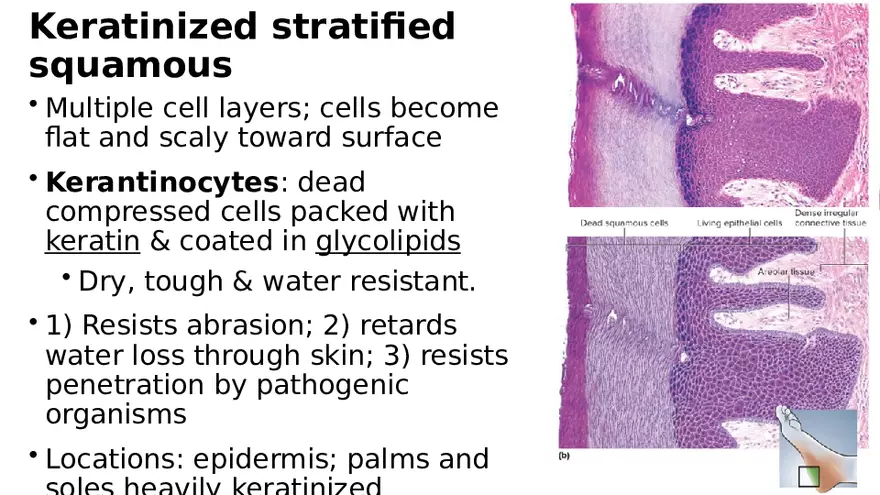 Chapter 5 Tissues – Epithelial, Connective, Muscle, Nervous, Membranes - Page 14