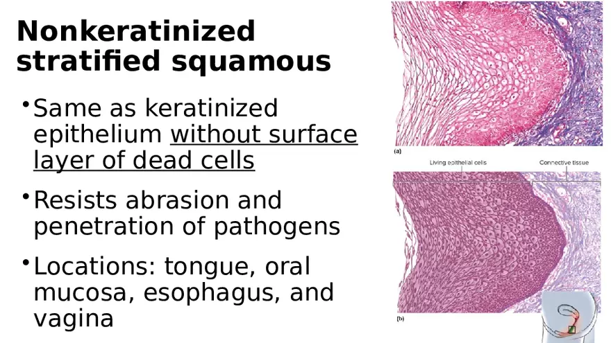 Chapter 5 Tissues – Epithelial, Connective, Muscle, Nervous, Membranes - Page 15