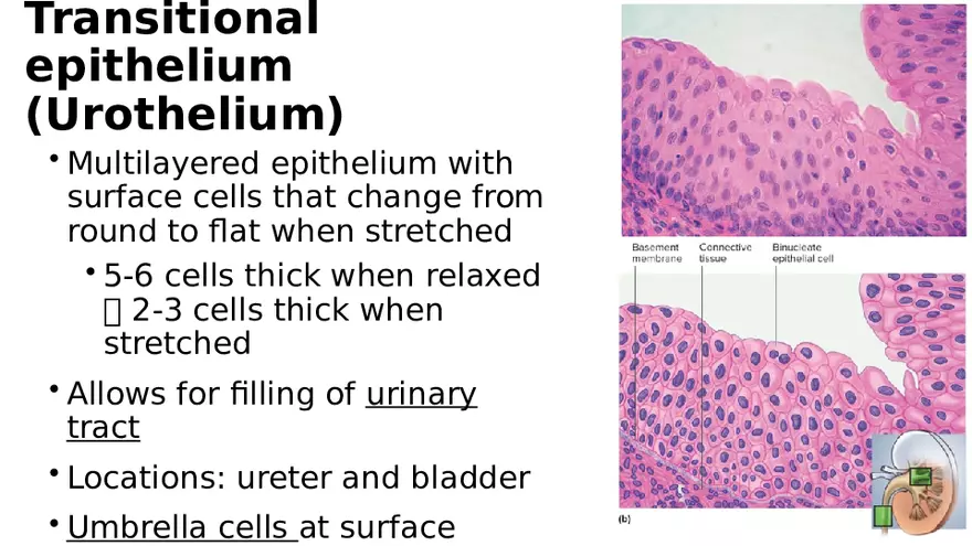 Chapter 5 Tissues – Epithelial, Connective, Muscle, Nervous, Membranes - Page 17