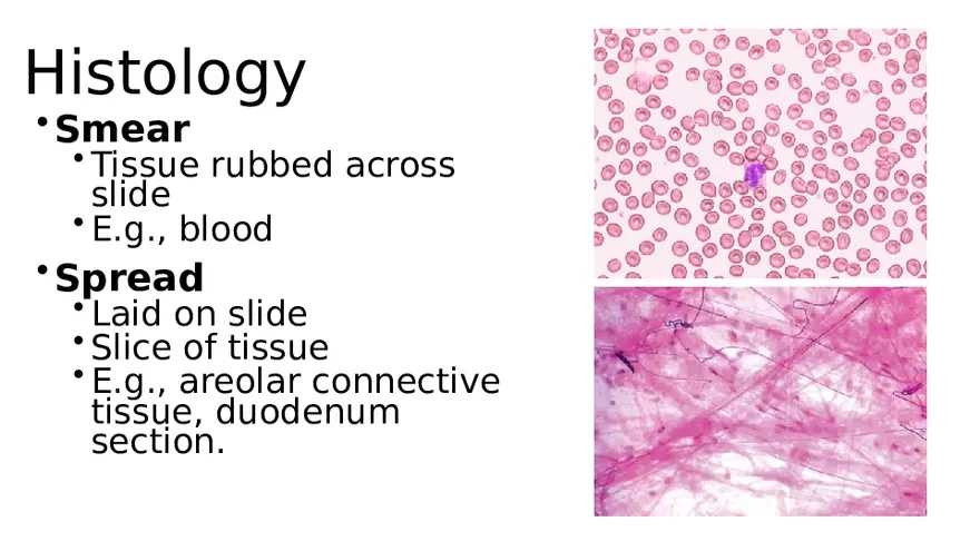 Chapter 5 Tissues – Epithelial, Connective, Muscle, Nervous, Membranes - Page 24