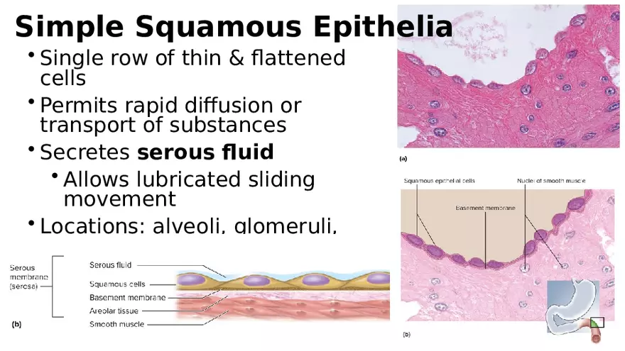 Chapter 5 Tissues – Epithelial, Connective, Muscle, Nervous, Membranes - Page 6