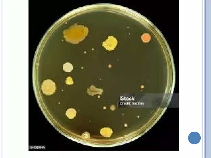 Bacterial Colonial Characteristics - Page 14