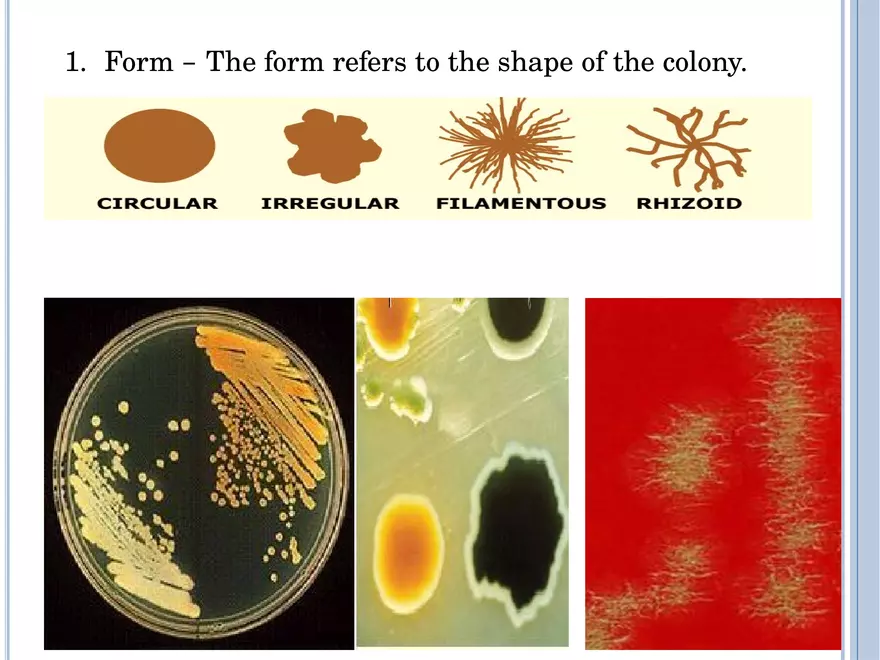 Bacterial Colonial Characteristics - Page 63