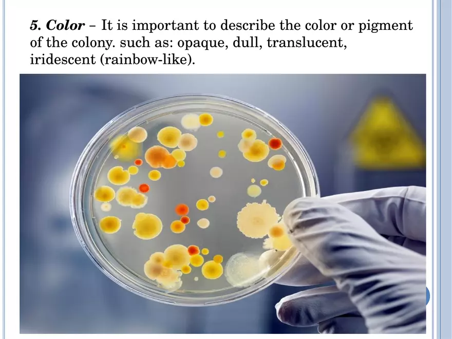 Bacterial Colonial Characteristics - Page 96