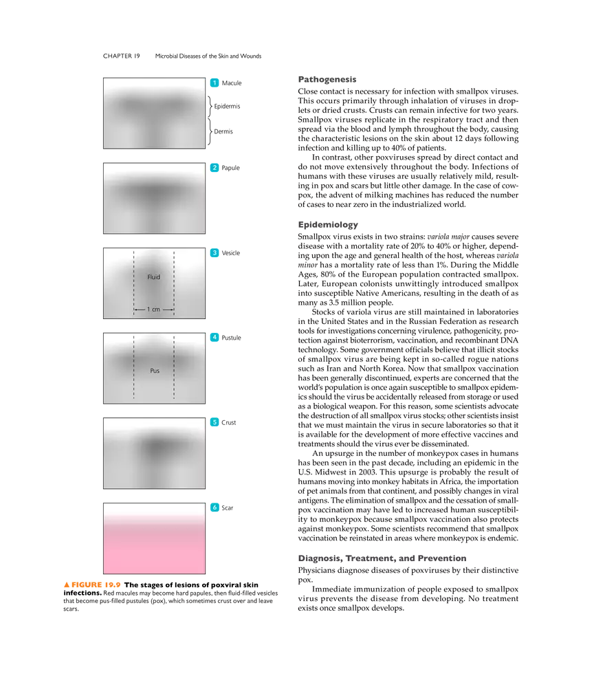 Microbial Diseases of the Skin and Wounds - Page 11