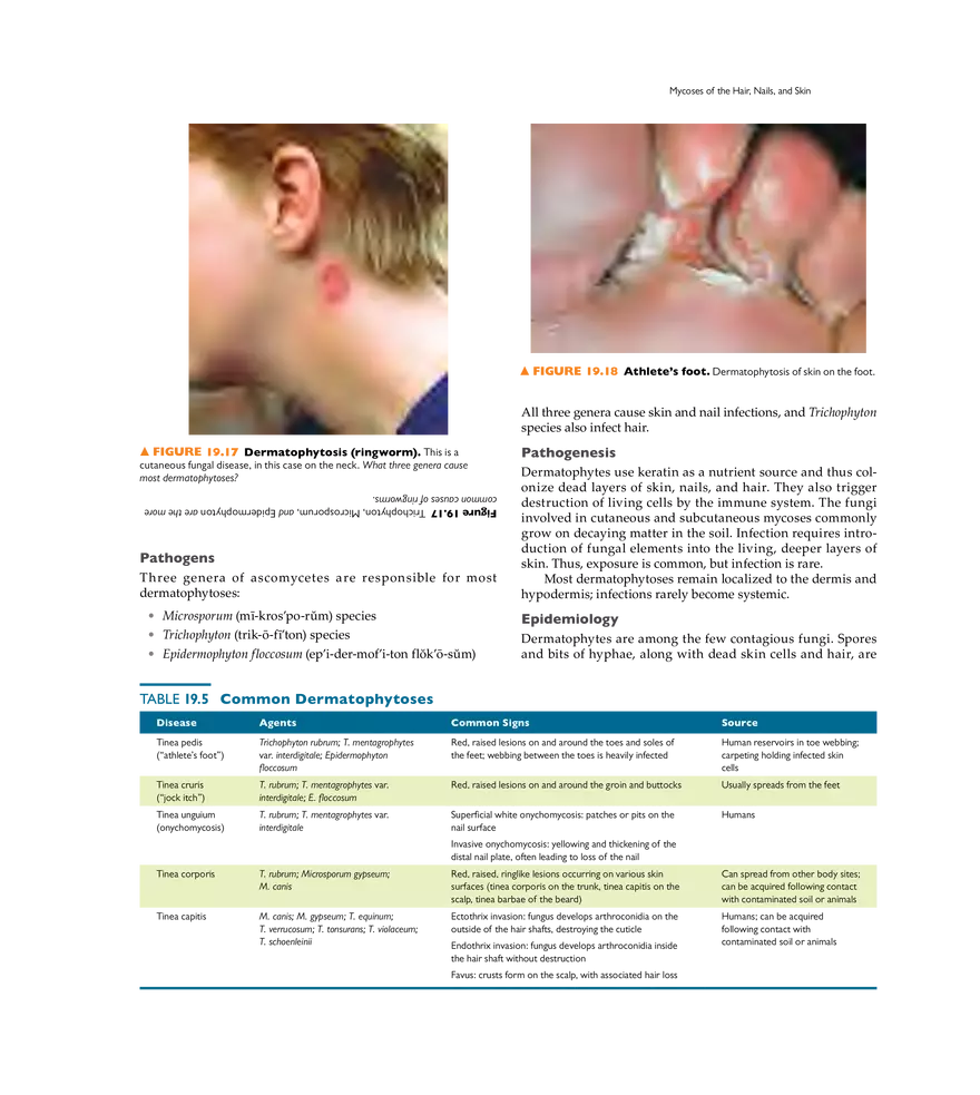 Microbial Diseases of the Skin and Wounds - Page 26