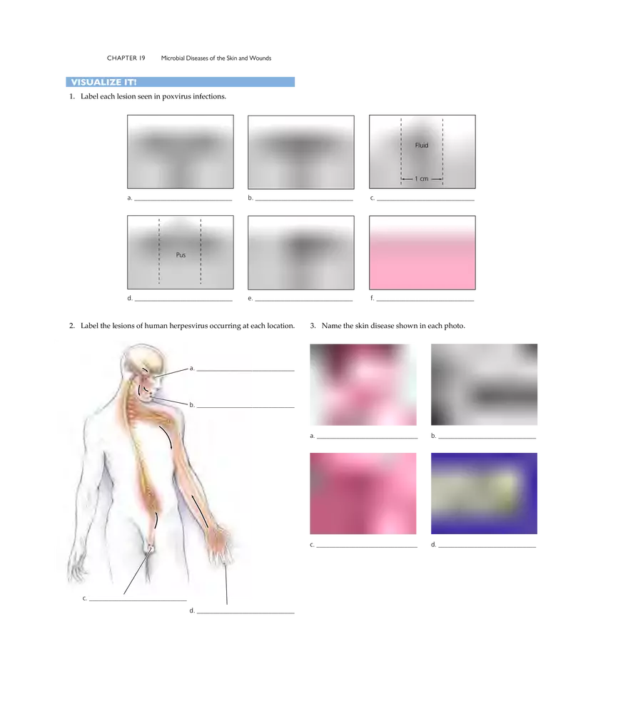 Microbial Diseases of the Skin and Wounds - Page 36