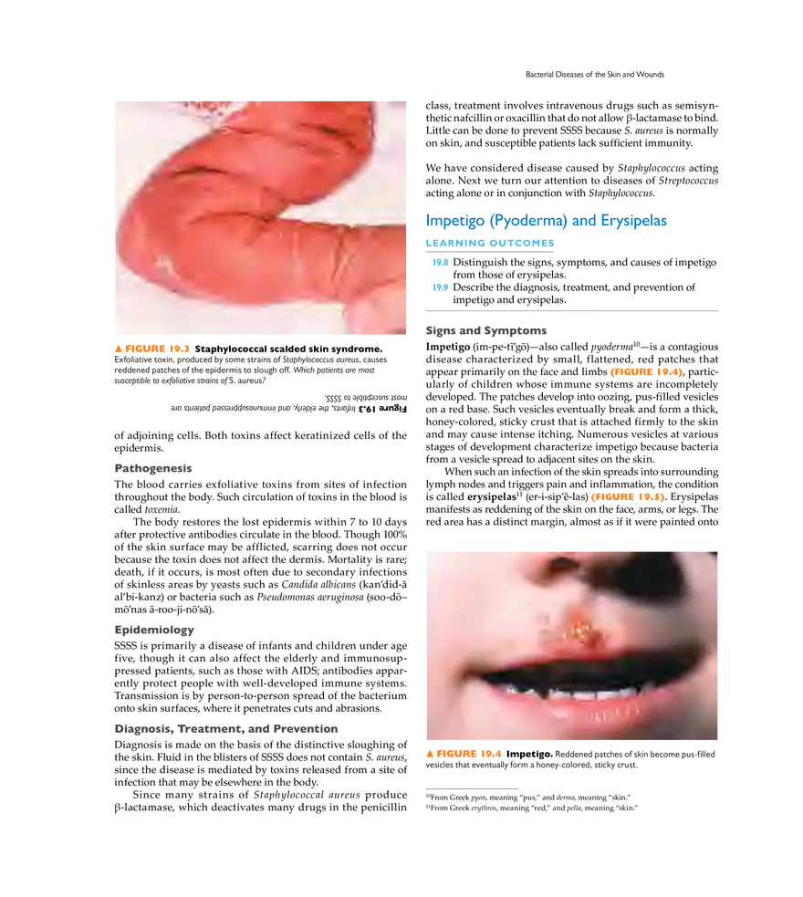 Microbial Diseases of the Skin and Wounds - Page 39