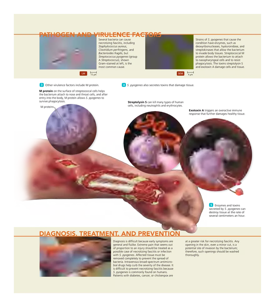 Microbial Diseases of the Skin and Wounds - Page 43