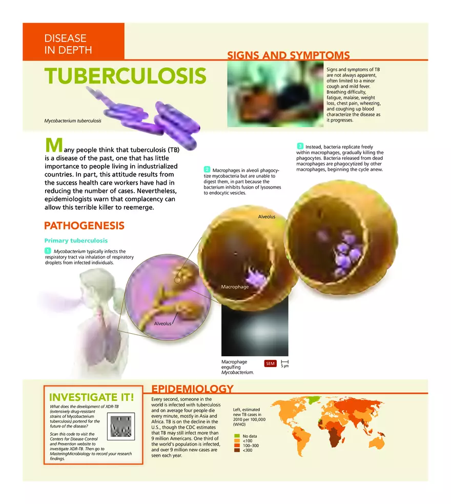Microbial Diseases of the Respiratory System - Page 7