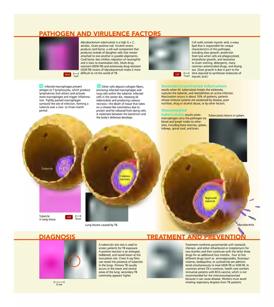 Microbial Diseases of the Respiratory System - Page 8