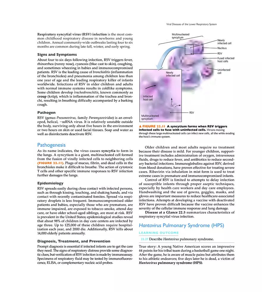 Microbial Diseases of the Respiratory System - Page 17