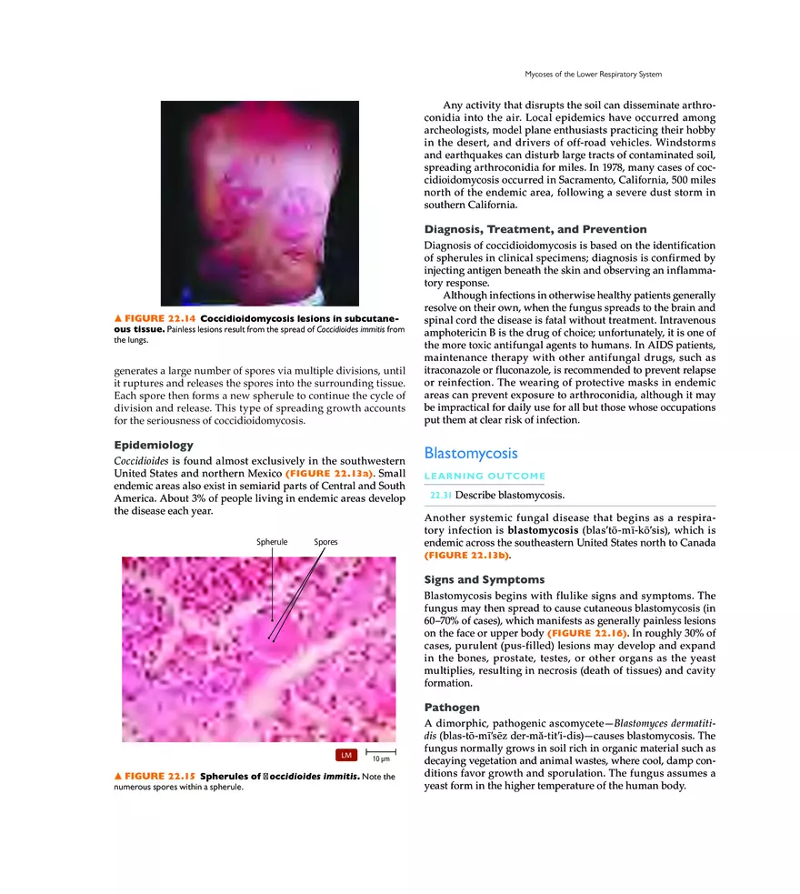 Microbial Diseases of the Respiratory System - Page 21