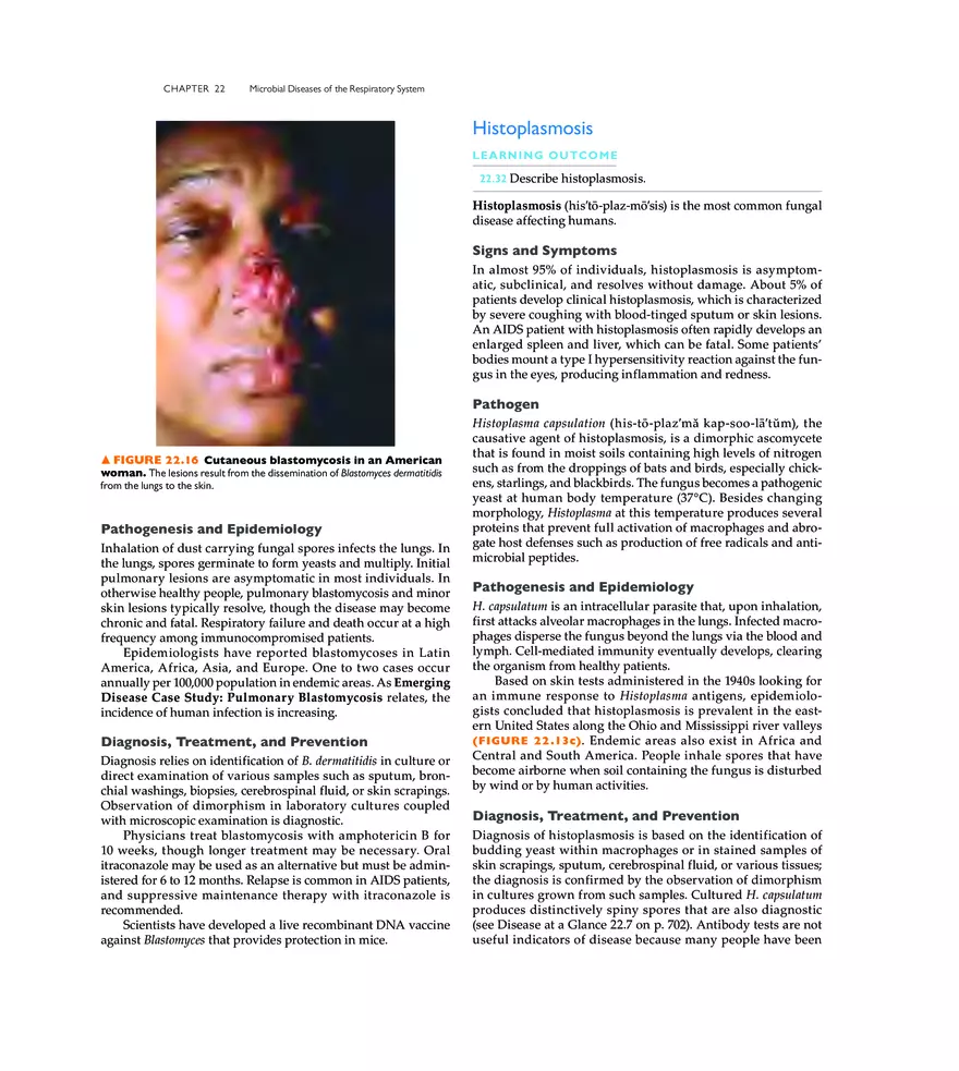Microbial Diseases of the Respiratory System - Page 22