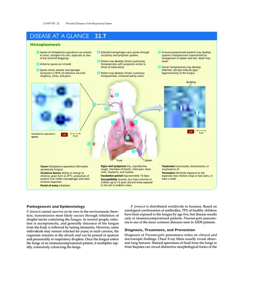 Microbial Diseases of the Respiratory System - Page 25