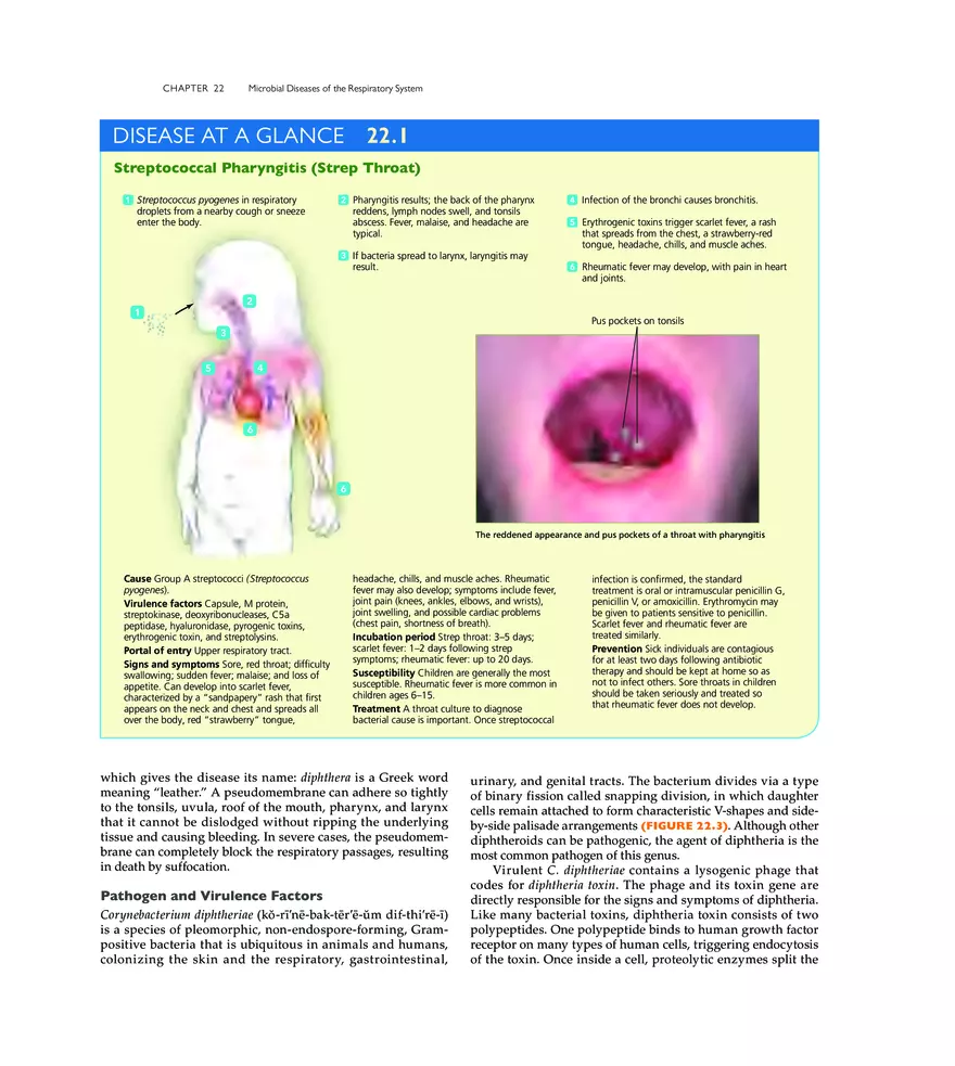 Microbial Diseases of the Respiratory System - Page 32