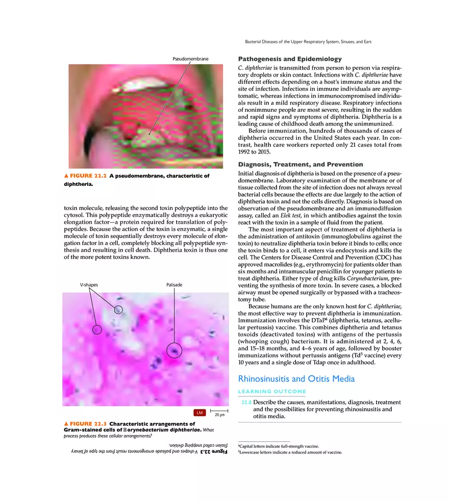 Microbial Diseases of the Respiratory System - Page 33