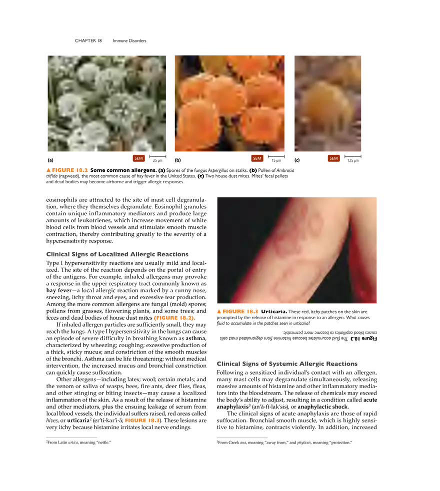 Immune Disorders - Page 13