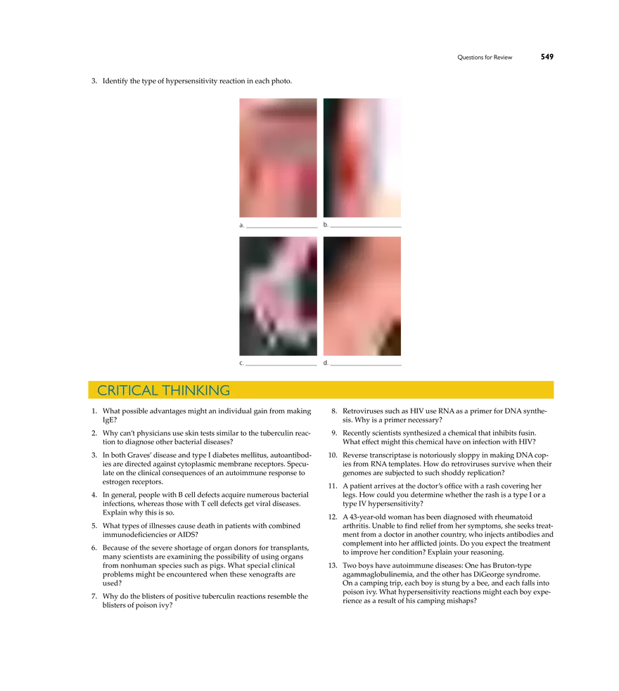 Immune Disorders - Page 21