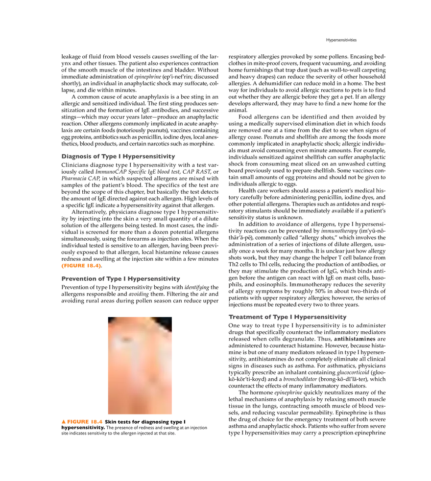 Immune Disorders - Page 23