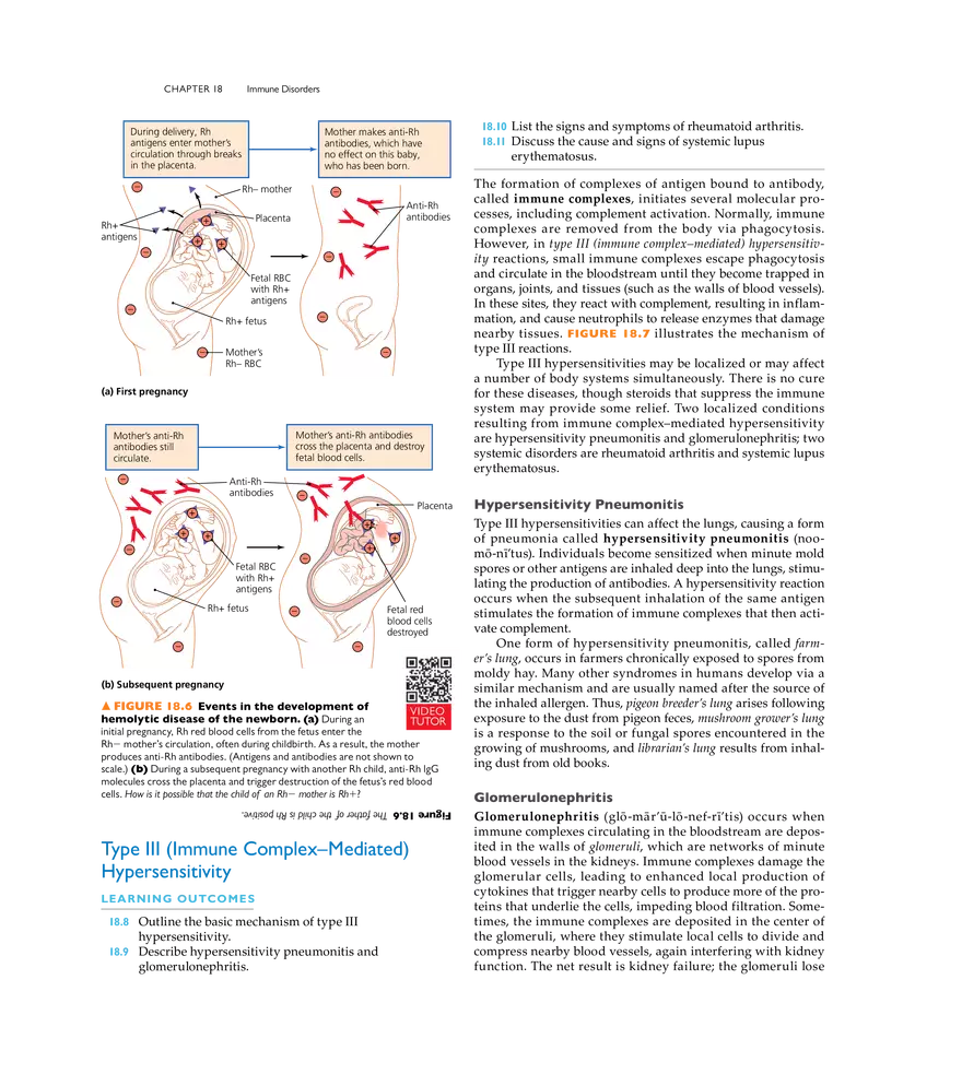 Immune Disorders - Page 26