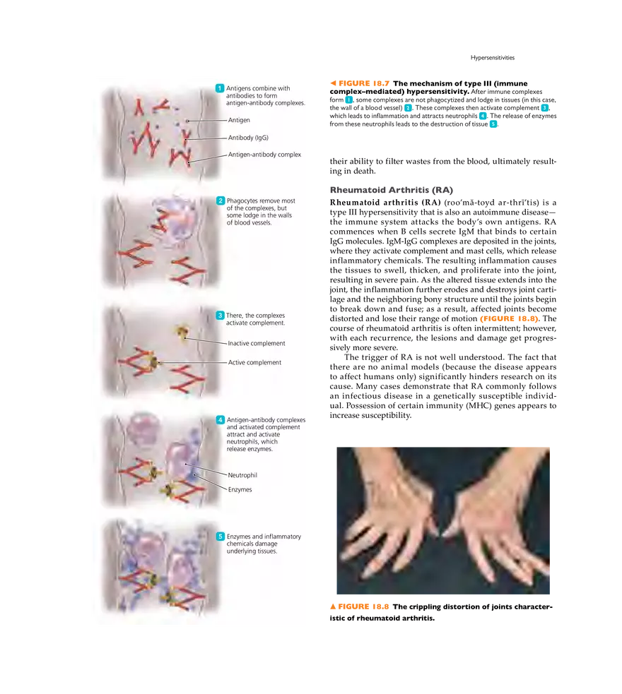 Immune Disorders - Page 27