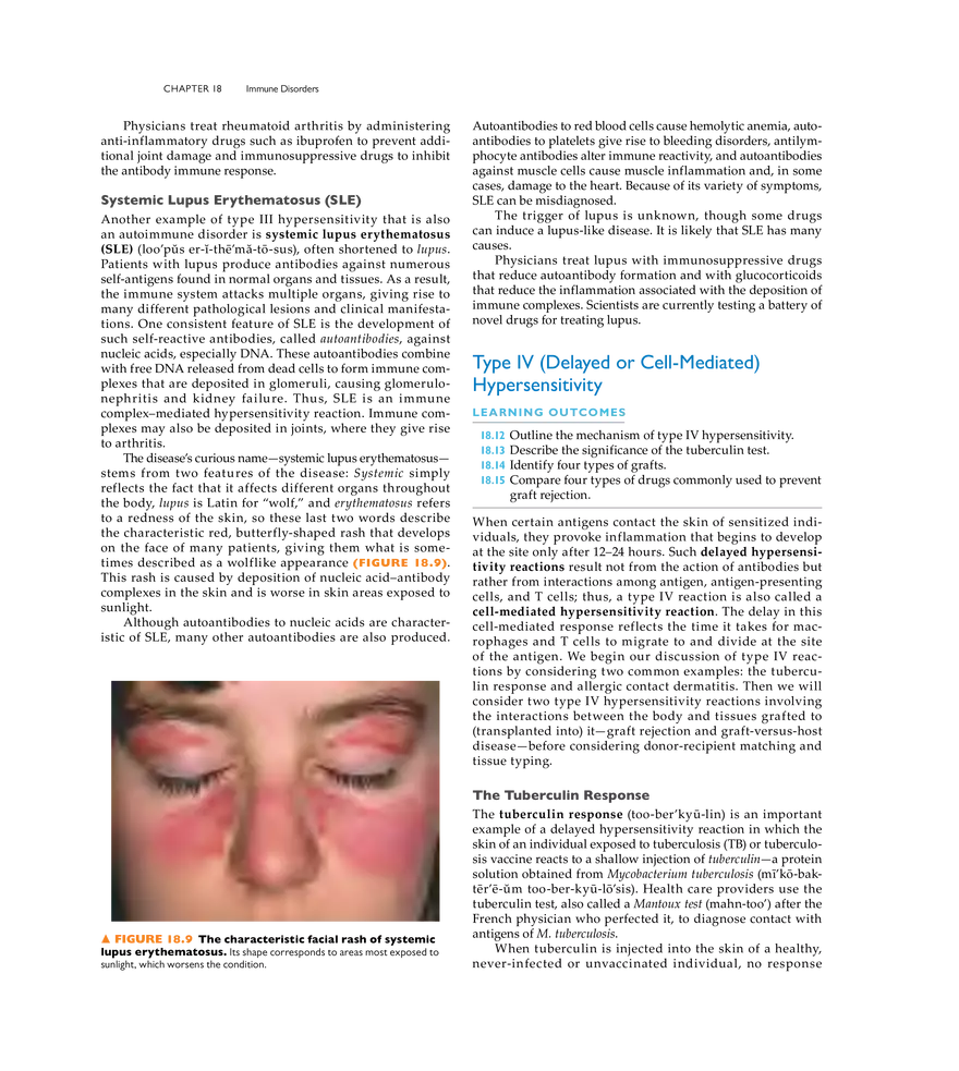 Immune Disorders - Page 28