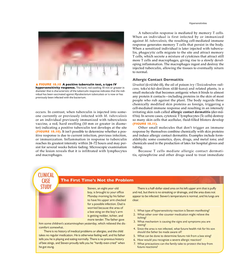 Immune Disorders - Page 29