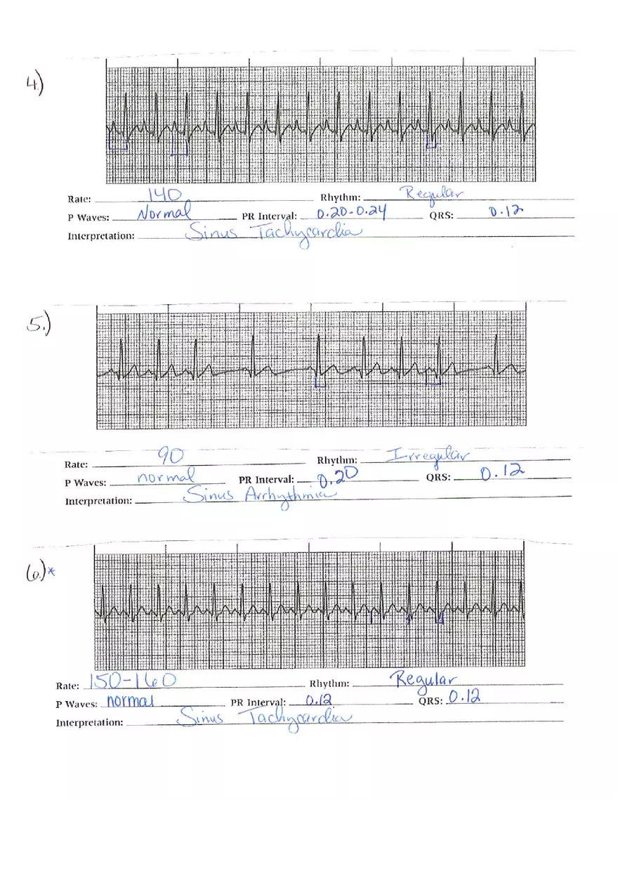 ECG Packet Answers - Page 7