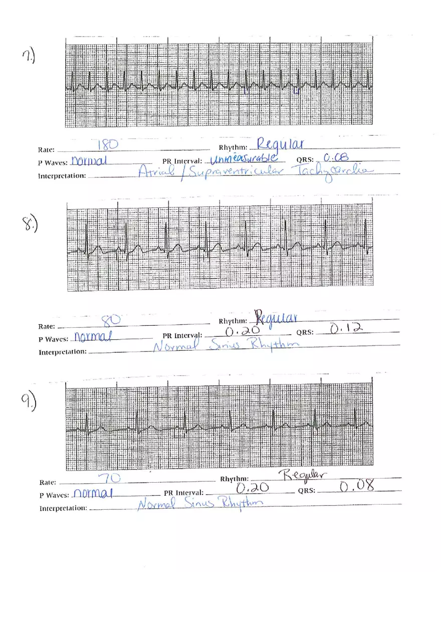 ECG Packet Answers - Page 8
