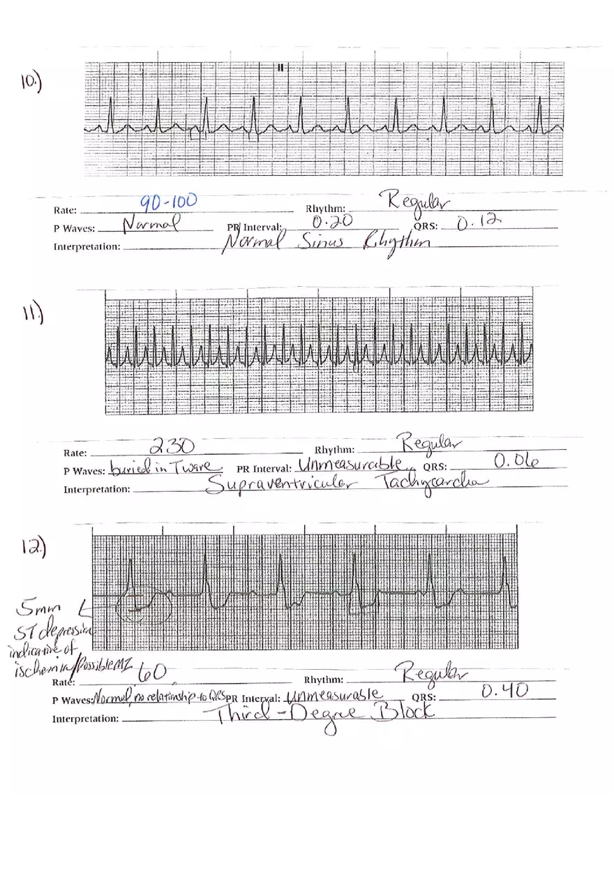 ECG Packet Answers - Page 9