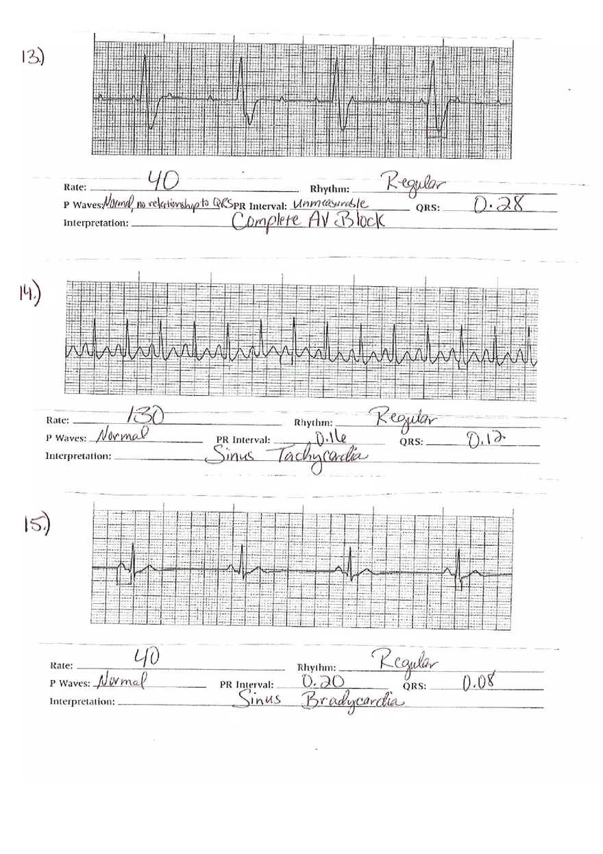 ECG Packet Answers - Page 10