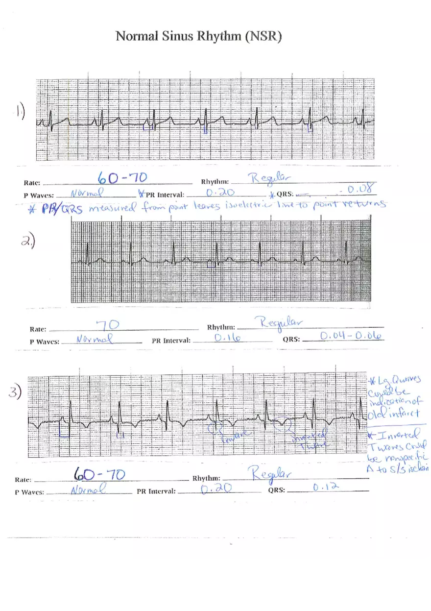 ECG Packet Answers - Page 1