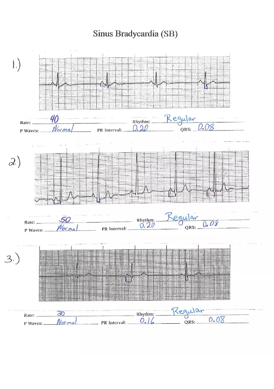 ECG Packet Answers - Page 2