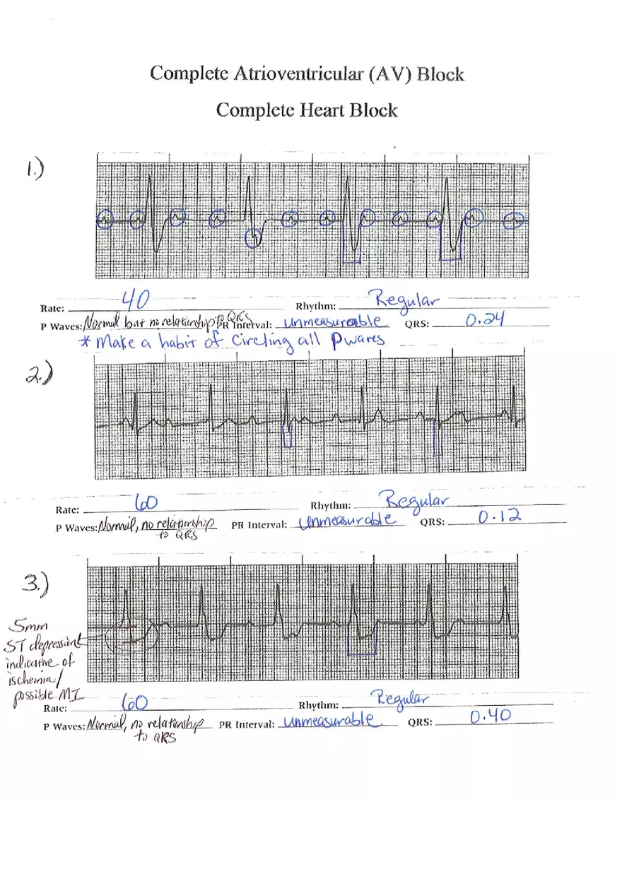 ECG Packet Answers - Page 3