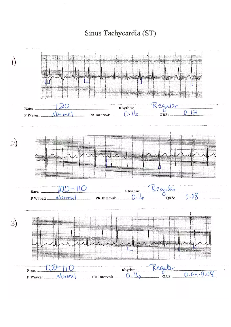 ECG Packet Answers - Page 4