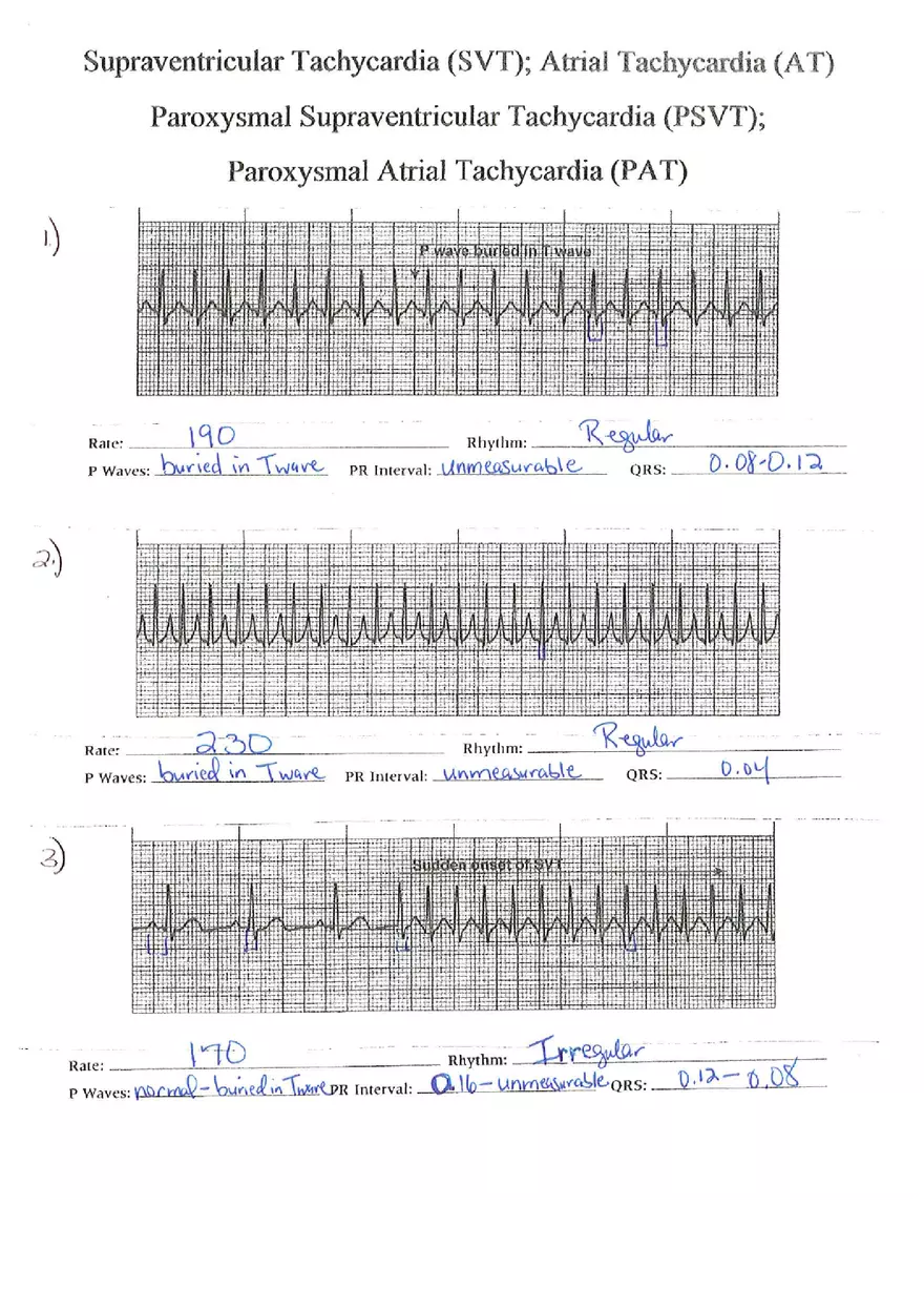 ECG Packet Answers - Page 5