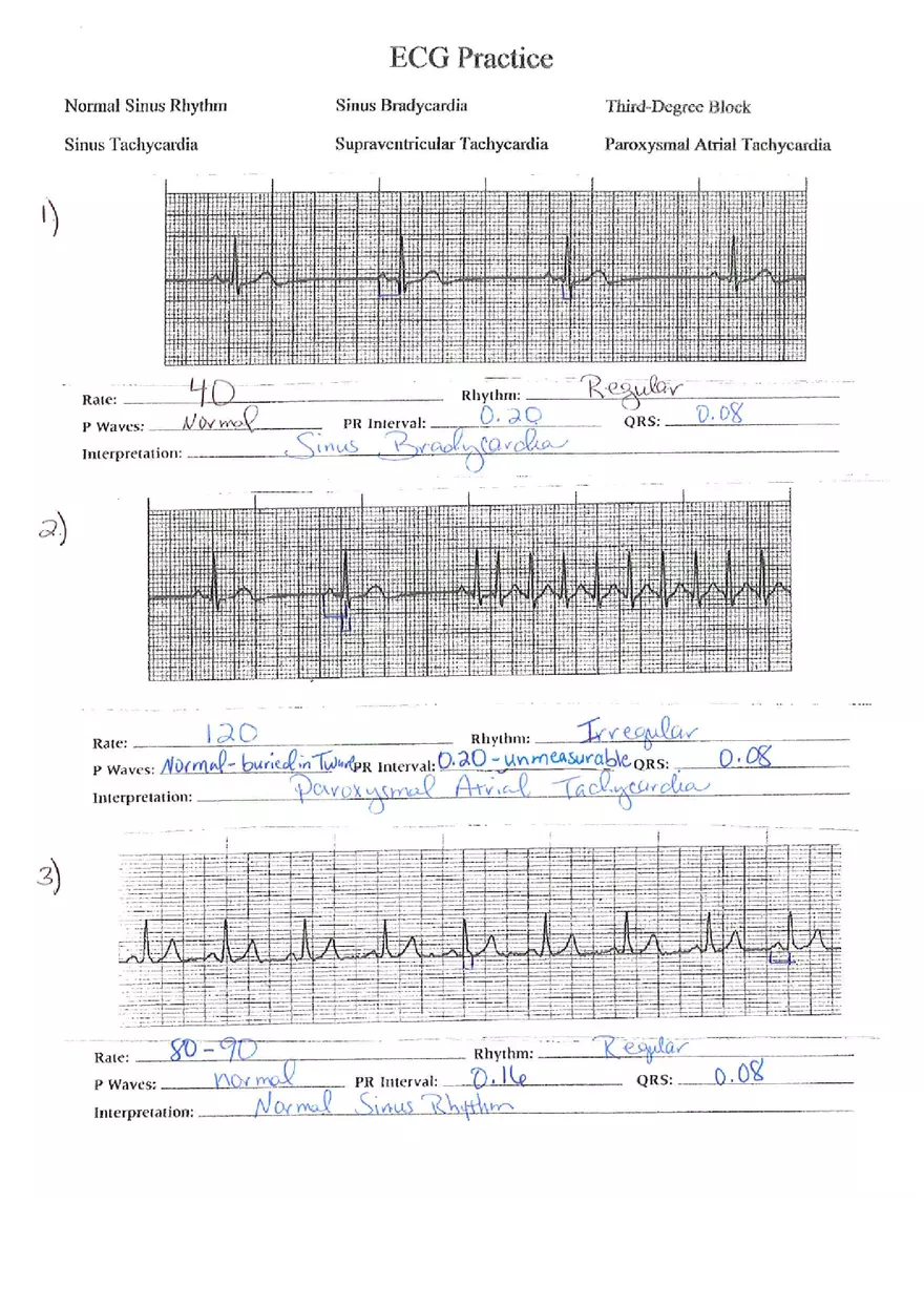 ECG Packet Answers - Page 6