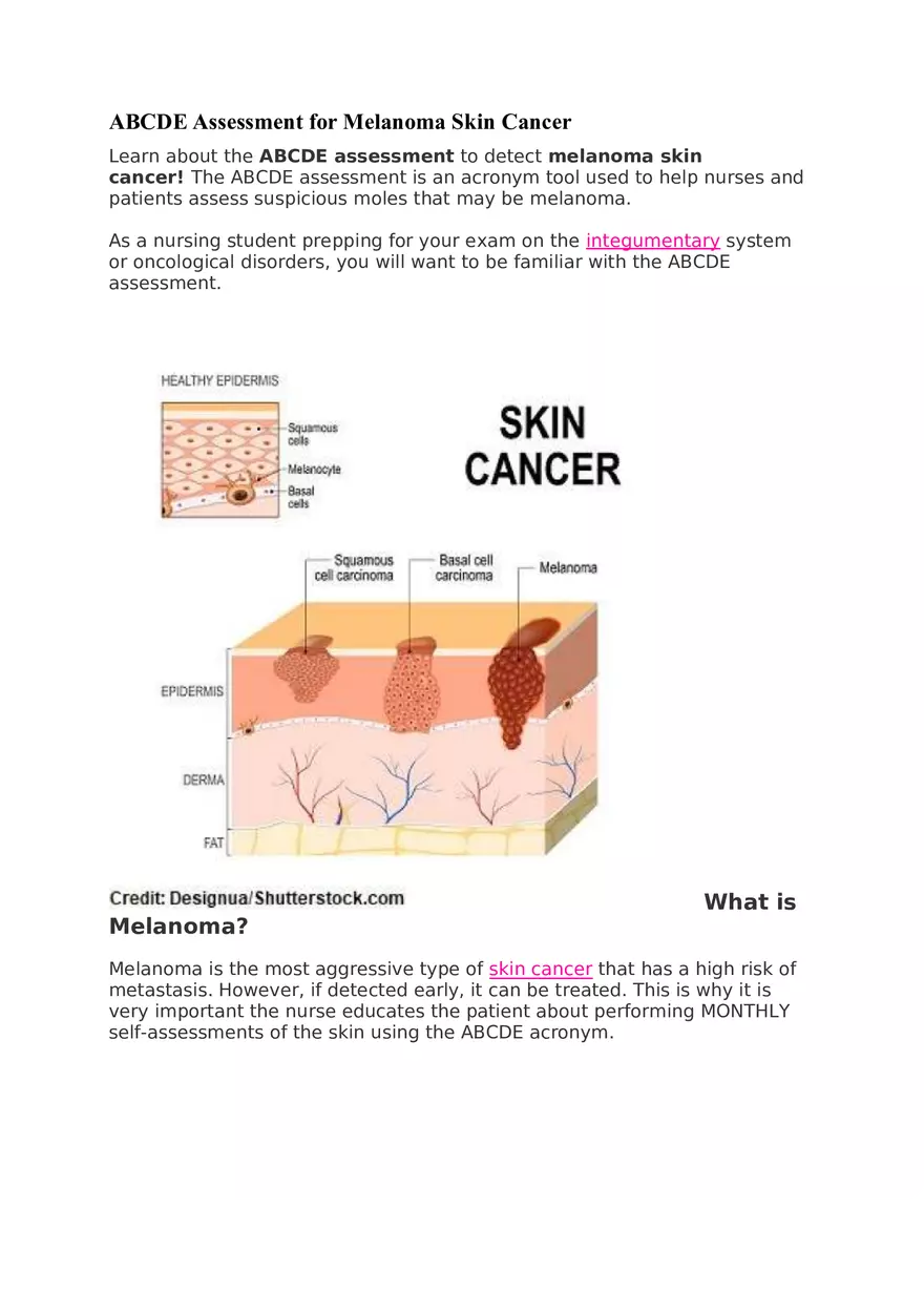 Assessment for Melanoma Skin Cancer - Page 1