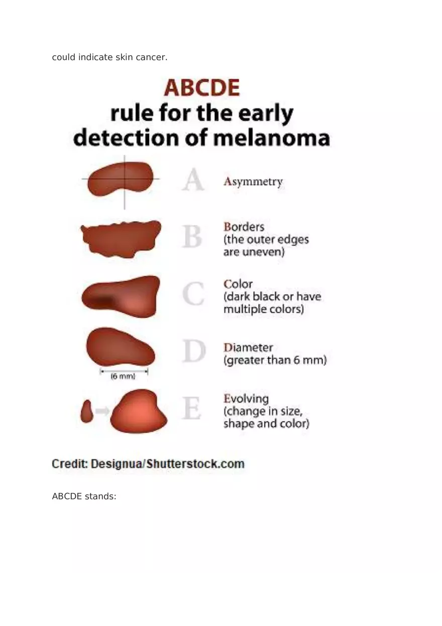 Assessment for Melanoma Skin Cancer - Page 3