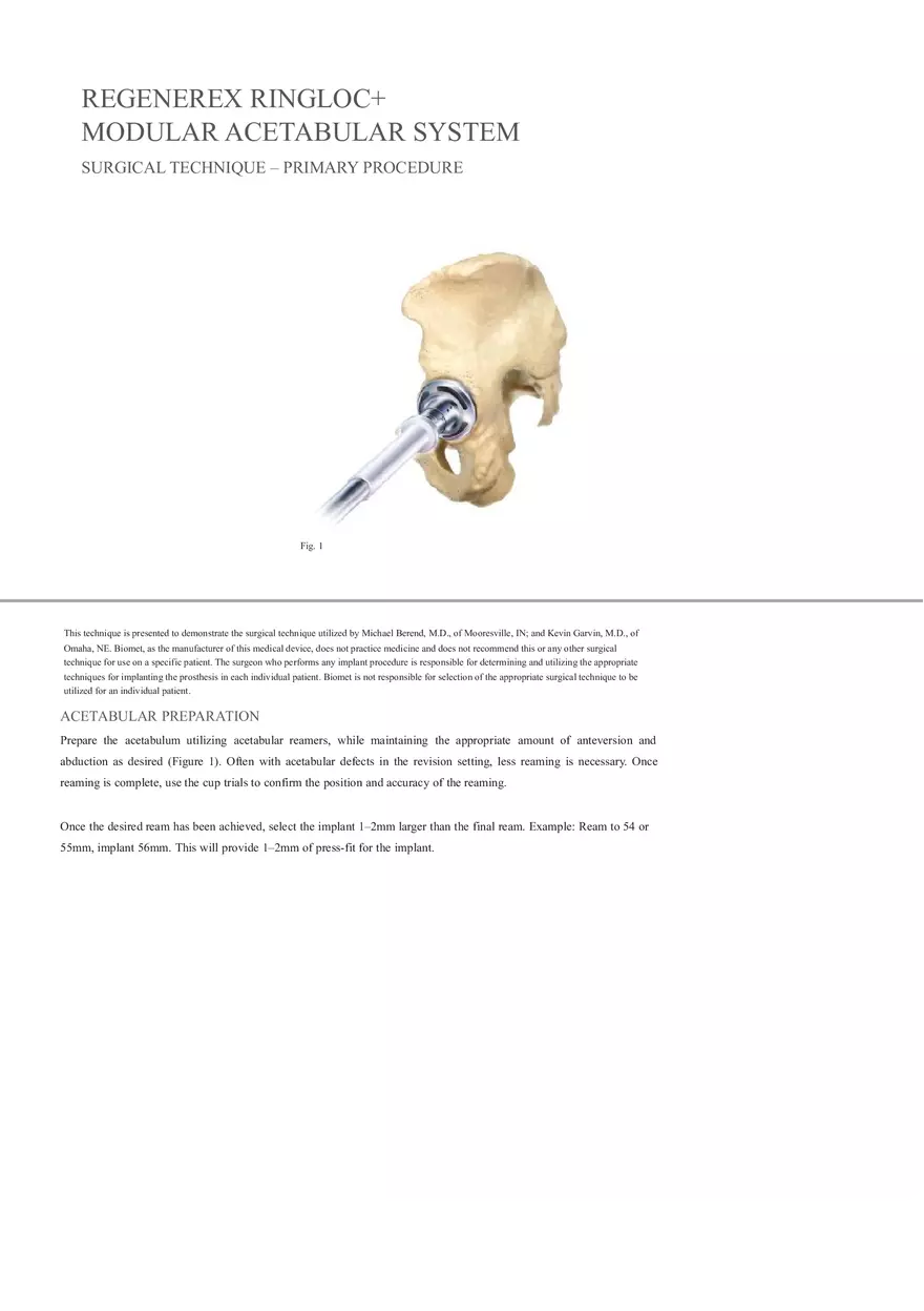 Regenerex Ringloc Surgical Technique - Page 1