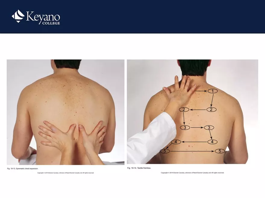 PN 158 Unit 10 Assessment of the Thorax and Lungs - Page 23