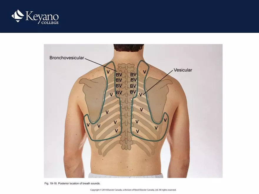 PN 158 Unit 10 Assessment of the Thorax and Lungs - Page 28