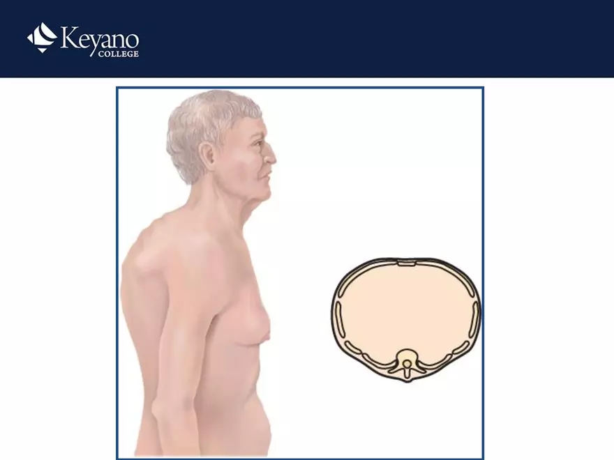 PN 158 Unit 10 Assessment of the Thorax and Lungs - Page 32