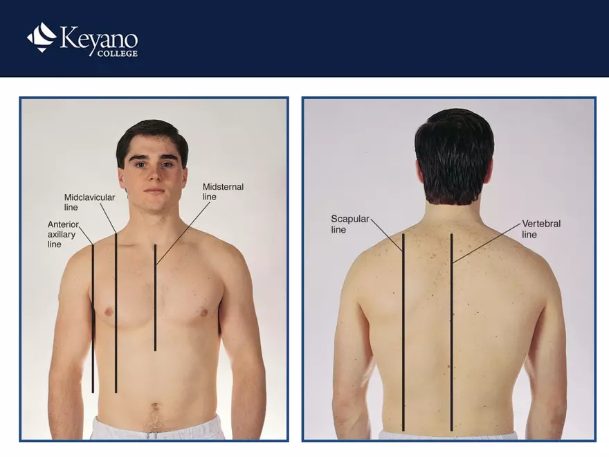 PN 158 Unit 10 Assessment of the Thorax and Lungs - Page 51